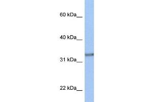 Human MCF-7; WB Suggested Anti-ACBD4 Antibody Titration: 0. (ACBD4 抗体  (N-Term))