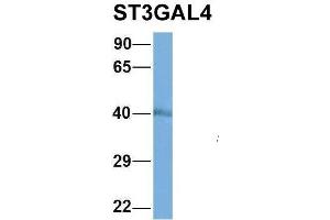 Host:  Rabbit  Target Name:  NOP56  Sample Type:  MCF7  Antibody Dilution:  1. (ST3GAL4 抗体  (Middle Region))