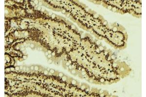 Immunohistochemistry (IHC) image for anti-SWI/SNF Related, Matrix Associated, Actin Dependent Regulator of Chromatin, Subfamily A, Member 4 (SMARCA4) (N-Term) antibody (ABIN6260313)