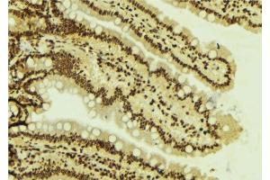 ABIN6277787 at 1/100 staining Mouse colon tissue by IHC-P. (SMARCA4 抗体  (N-Term))