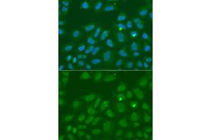Immunofluorescence analysis of A549 cells using ORC6 antibody (ABIN5973151). (ORC6 抗体)
