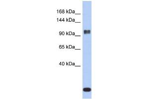 WB Suggested Anti-ATXN7 Antibody Titration: 0.