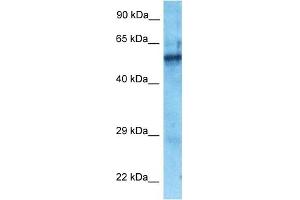 Host:  Rabbit  Target Name:  ZNF25  Sample Type:  Fetal Lung lysates  Antibody Dilution:  1. (ZNF25 抗体  (N-Term))