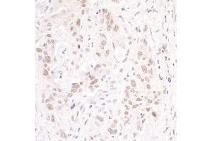 Immunohistochemistry (IHC) image for anti-GATA Zinc Finger Domain Containing 2B (GATAD2B) (AA 543-593) antibody (ABIN7454396)