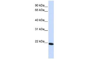 Claudin 19 antibody used at 1 ug/ml to detect target protein.