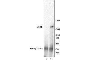 ZEB1 antibody (pAb) tested by Immunoprecipitation. (ZEB1 抗体  (N-Term))