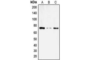 Western blot analysis of SLC6A14 expression in SKNMC (A), COLO205 (B), HL60 (C) whole cell lysates.
