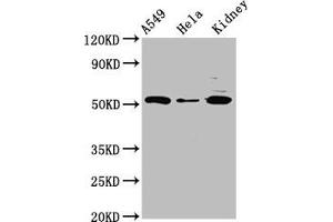 Western Blot Positive WB detected in: A549 whole cell lysate, Hela whole cell lysate, Rat kidney tissue All lanes: FICD antibody at 3 μg/mL Secondary Goat polyclonal to rabbit IgG at 1/50000 dilution Predicted band size: 52 kDa Observed band size: 52 kDa