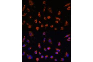 Immunofluorescence analysis of L929 cells using TMEM25 antibody (ABIN7270963) at dilution of 1:100. (TMEM25 抗体  (AA 223-322))