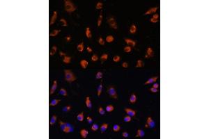 Immunofluorescence analysis of L929 cells using TMEM25 antibody (ABIN7270963) at dilution of 1:100. (TMEM25 抗体  (AA 223-322))