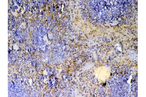 IHC analysis of ICOS using anti-ICOS antibody . (ICOS 抗体  (AA 21-200))