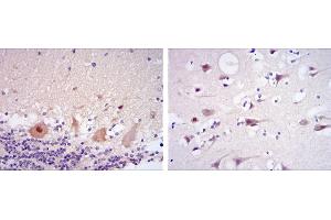 Immunohistochemistry (IHC) image for anti-Cyclin-Dependent Kinase 5 (CDK5) antibody (ABIN969041)