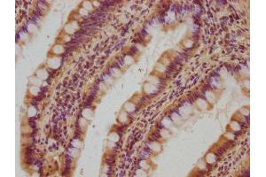 IHC image of ABIN7162407 diluted at 1:100 and staining in paraffin-embedded human small intestine tissue performed on a Leica BondTM system. (OSBPL7 抗体  (AA 1-249))