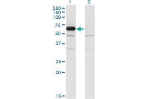 Western Blot analysis of DPYSL4 expression in transfected 293T cell line by DPYSL4 monoclonal antibody (M01), clone 1F5. (DPYSL4 抗体  (AA 461-559))