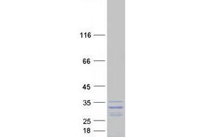 Validation with Western Blot (GAR1 Protein (Transcript Variant 1) (Myc-DYKDDDDK Tag))