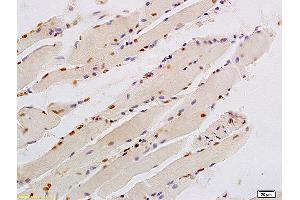 Formalin-fixed and paraffin embedded human smooth muscle labeled with Anti-KLF6/PAC1 Polyclonal Antibody, Unconjugated (ABIN685927) at 1:200 followed by conjugation to the secondary antibody and DAB staining. (KLF6 抗体)