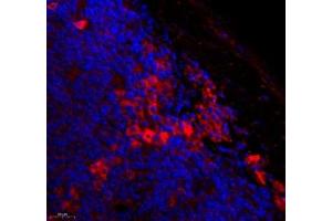 Immunofluorescence (Paraffin-embedded Sections) (IF (p)) image for anti-Membrane-Spanning 4-Domains, Subfamily A, Member 2 (Fc Fragment of IgE, High Affinity I, Receptor For, beta Polypeptide) (MS4A2) antibody (ABIN7074594)