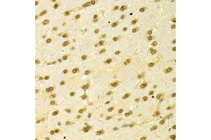 Immunohistochemistry of paraffin-embedded rat brain using HDGF Antibody (ABIN1876535) at dilution of 1:100 (40x lens). (HDGF 抗体)