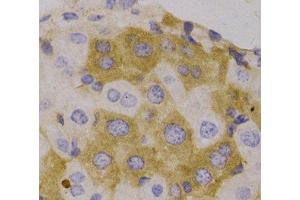 Immunohistochemistry of paraffin-embedded Human liver, using NBR1 Polyclonal Antibody (NBR1 抗体)