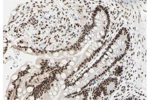 ABIN6266854 at 1/100 staining human colon tissue sections by IHC-P. (PRKDC 抗体  (Internal Region))