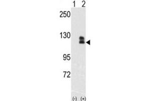 Western Blotting (WB) image for anti-EPH Receptor B2 (EPHB2) antibody (ABIN3003348) (EPH Receptor B2 抗体)