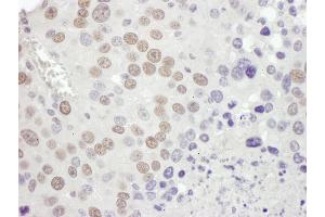 Immunohistochemistry (IHC) image for anti-Mismatch Repair Protein 2 (MSH2) (C-Term) antibody (ABIN7453440)