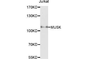 Western blot analysis of extracts of Jurkat cells，using MUSK antibody. (MUSK 抗体)