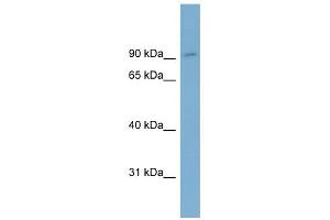 OSBPL1A antibody used at 1 ug/ml to detect target protein. (OSBPL1A 抗体  (Middle Region))