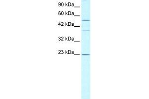 WB Suggested Anti-ZNFN1A1 Antibody Titration:  0. (IKZF1 抗体  (Middle Region))