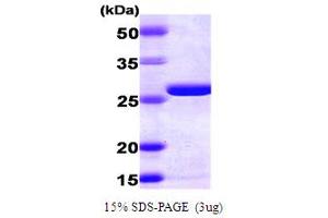 Adenylate Kinase 2 (AK2) (AA 1-239) protein (His tag)