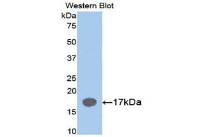Detection of Recombinant IL1RA, Mouse using Polyclonal Antibody to Interleukin 1 Receptor Antagonist (IL1RA)