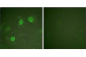 Immunofluorescence analysis of HeLa cells, using GATA3 (Ab-308) Antibody. (GATA3 抗体  (AA 274-323))