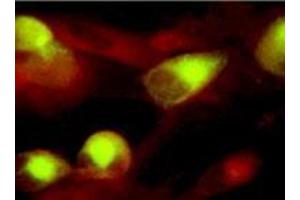 Immunofluorescence (IF) image for anti-CMV gB antibody (ABIN265540) (CMV gB 抗体)