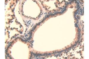 Detection of LOXL3 in Mouse Lung Tissue using Polyclonal Antibody to Lysyl Oxidase Like Protein 3 (LOXL3) (LOXL3 抗体  (AA 509-712))