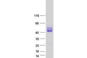 Western Blotting (WB) image for Coagulation Factor III (thromboplastin, Tissue Factor) (F3) protein (Myc-DYKDDDDK Tag) (ABIN2713425)