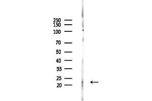 Western blot analysis of lysates from COLO205 cells(heat-shock,45 min treatment), using Phospho-BID (Ser78) Antibody at 1/1000 dilution.