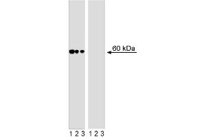 Western blot analysis of AKT (pS473) in human T leukemia. (AKT1 抗体  (pSer473))