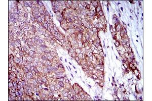 Immunohistochemistry (IHC) image for anti-Zinc Finger Protein 42 (ZFP42) (AA 249-310) antibody (ABIN1846770)