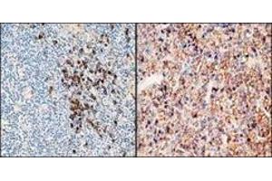 Immunohistochemistry (IHC) image for Rabbit anti-Human Ig (Chain kappa), (Light Chain), (N-Term) antibody (ABIN870362) (兔 anti-人 Ig (Chain kappa), (Light Chain), (N-Term) Antibody)