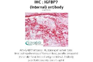 Image no. 2 for anti-Insulin-Like Growth Factor Binding Protein 7 (IGFBP7) (Internal Region) antibody (ABIN1735789) (IGFBP7 抗体  (Internal Region))