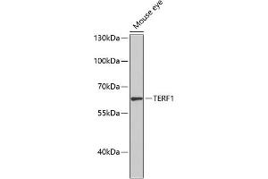 Western blot analysis of extracts of mouse eye, using TERF1 antibody (ABIN1683138, ABIN3015078, ABIN3015079 and ABIN6213631) at 1:1000 dilution. (TRF1 抗体  (AA 240-419))
