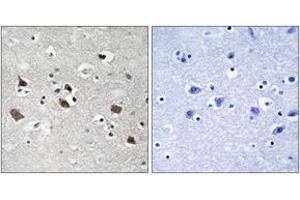 Immunohistochemistry analysis of paraffin-embedded human brain, using SLP-76 (Phospho-Tyr128) Antibody. (LCP2 抗体  (pTyr128))