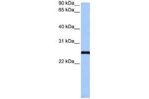 WB Suggested Anti-CCDC46 Antibody Titration: 0. (CCDC46 抗体  (C-Term))