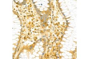 Immunohistochemistry (Paraffin-embedded Sections) (IHC (p)) image for anti-Protein Tyrosine Phosphatase G1 (PTPN12) antibody (ABIN7075292)
