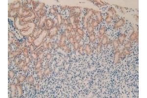 Detection of PLXNB1 in Mouse Kidney Tissue using Polyclonal Antibody to Plexin B1 (PLXNB1) (PLXNB1 抗体  (AA 1598-1849))