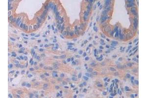 IHC-P analysis of Mouse Uterus Tissue, with DAB staining. (IL18RAP 抗体  (AA 396-548))