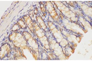 Immunohistochemistry of paraffin-embedded Mouse colon using HRAS Polycloanl Antibody at dilution of 1:200 (HRAS 抗体)