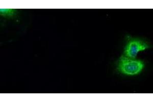 Image no. 7 for anti-B-Raf proto-oncogene, serine/threonine kinase (BRAF) antibody (ABIN1496954)