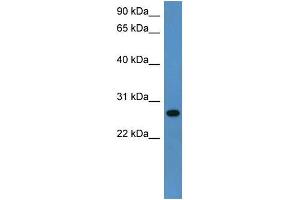 Rat Lung; WB Suggested Anti-Cyb5r2 Antibody Titration: 0. (CYB5R2 抗体  (C-Term))