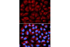 Immunofluorescence analysis of U2OS cell using FANCC antibody. (FANCC 抗体  (AA 319-558))